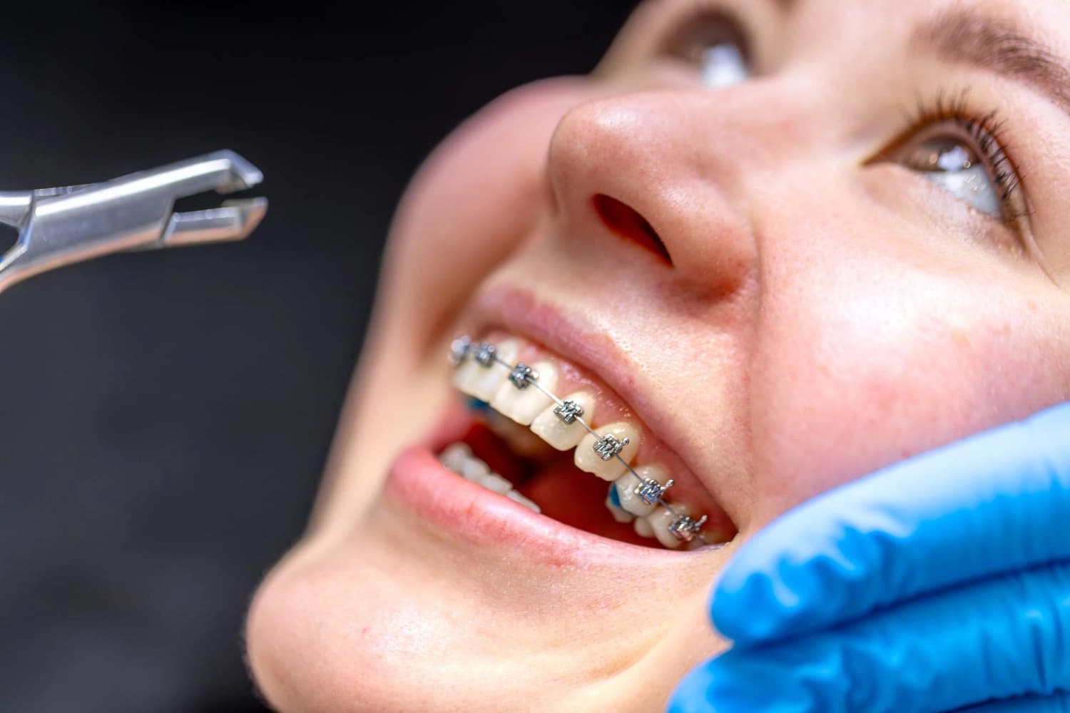 تقويم الأسنان في دبي: دليل شامل للتقويم وأنواعه وتكلفته وعلاجه