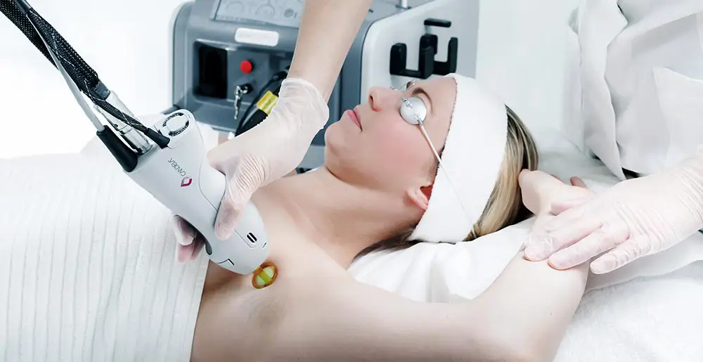 Laser Hair Removal